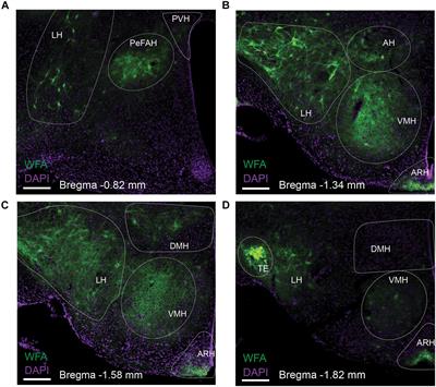 Hypothalamic Perineuronal Nets Are Regulated by Sex and Dietary Interventions